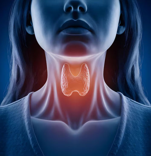 Hypothyroidism