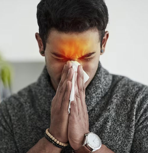 Sinusitis